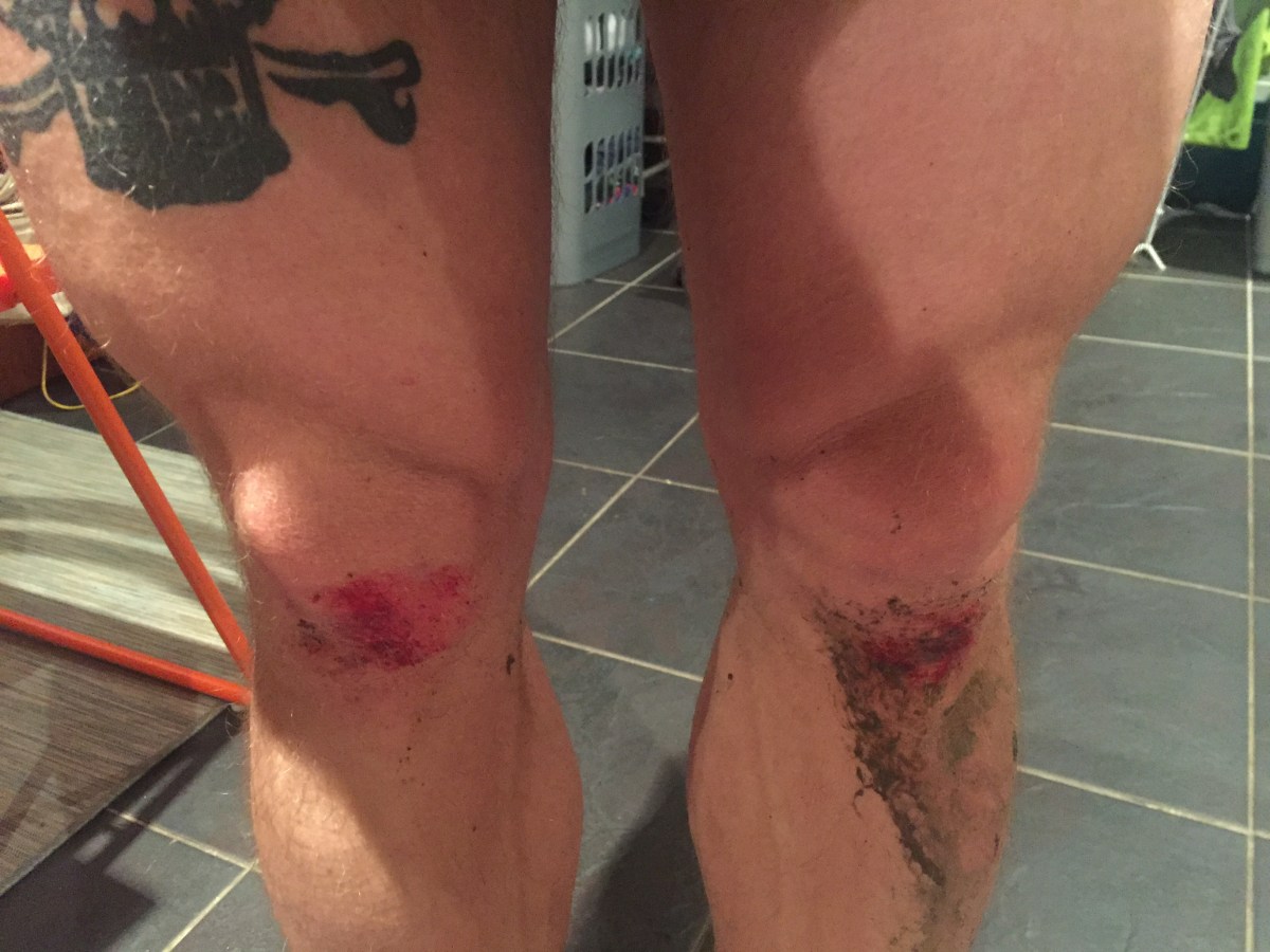 Friday thoughts #9:&nbsp;Pain